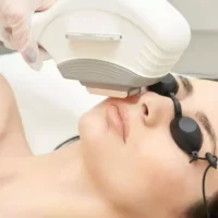 5 Upper Face / Lower Face Laser Hair Reduction