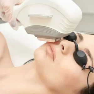 5 Upper Face / Lower Face Laser Hair Reduction