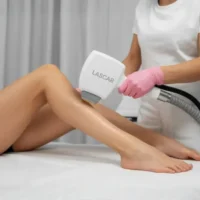 Full Legs Laser Polishing