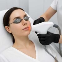 Full Face Laser Hair Reduction