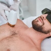 wer Full Front laser Hair Reduction (Men)